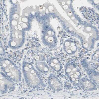 Immunohistochemistry-Paraffin: PIP Antibody [NBP1-83386]