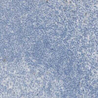 Immunohistochemistry-Paraffin: PIP Antibody [NBP1-83386]