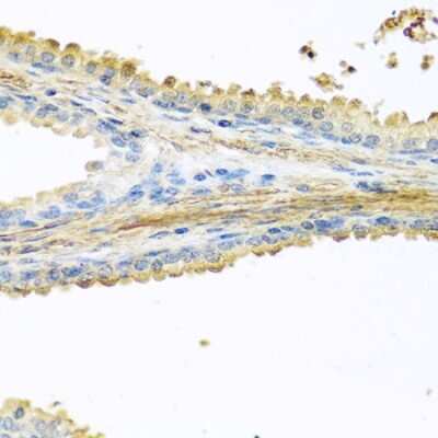 Immunohistochemistry-Paraffin: PIP Antibody - BSA Free [NBP2-93942]