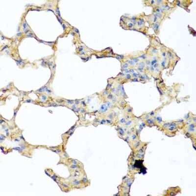 Immunohistochemistry-Paraffin: PIP Antibody - BSA Free [NBP2-93942]