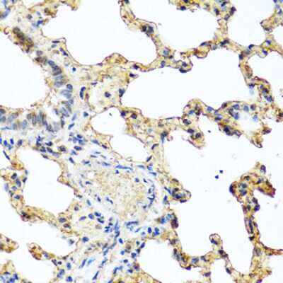 Immunohistochemistry-Paraffin: PIP Antibody - BSA Free [NBP2-93942]