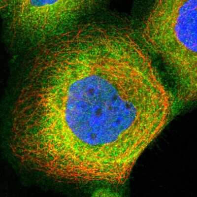 Immunocytochemistry/ Immunofluorescence: PIP5K1 alpha Antibody [NBP1-90358]