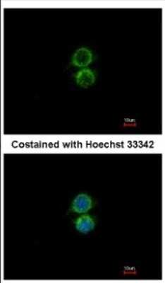 Immunocytochemistry/ Immunofluorescence: PIP5K1 alpha Antibody [NBP2-19833]