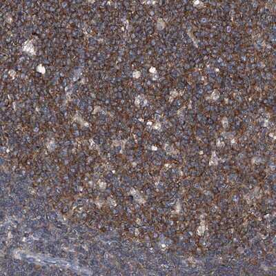 Immunohistochemistry-Paraffin: PIP5K1 alpha Antibody [NBP1-90358]