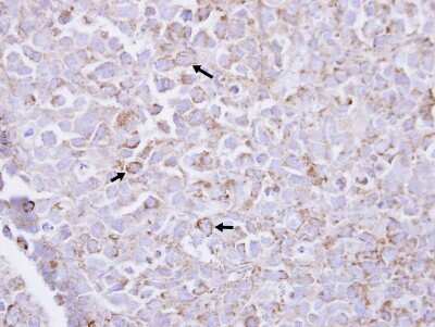 Immunohistochemistry-Paraffin: PIP5K1 alpha Antibody [NBP2-19833]