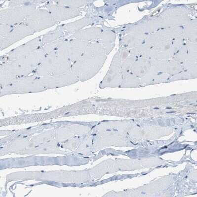 Immunohistochemistry-Paraffin: PIP5K1C Antibody [NBP1-82986]