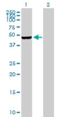 Western Blot: PIP5K2 gamma Antibody [H00079837-B01P]