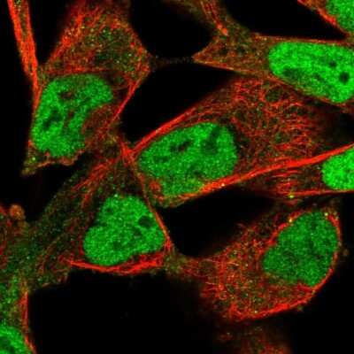 Immunocytochemistry/ Immunofluorescence: PIP5K2B Antibody [NBP2-56946]