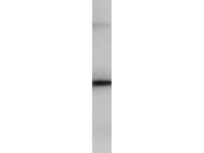 Western Blot: PIP5K2B Antibody [NBP1-44261]