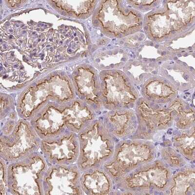 Immunohistochemistry-Paraffin: PIP5KL1 Antibody [NBP2-33779]