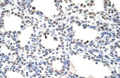 Immunohistochemistry-Paraffin: PIPPIN Antibody [NBP1-70673]
