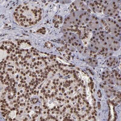 Immunohistochemistry-Paraffin: PIPPIN Antibody [NBP1-87271]