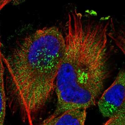 Immunocytochemistry/ Immunofluorescence: PISD Antibody [NBP1-84212]