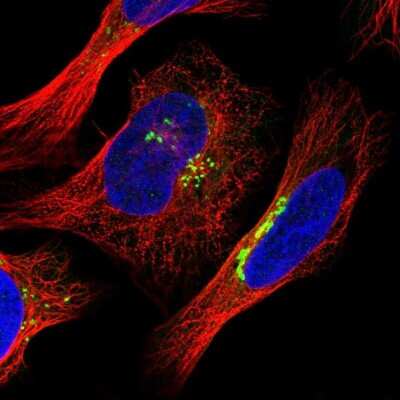 Immunocytochemistry/ Immunofluorescence: PIST Antibody [NBP1-88223]