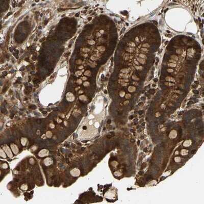 Immunohistochemistry-Paraffin: PIST Antibody [NBP1-88222]