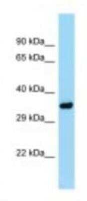 Western Blot: PITPN Antibody [NBP1-98374]