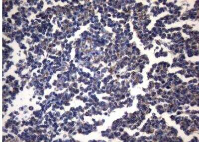 Immunohistochemistry-Paraffin: PITPNB Antibody (OTI6H10) [NBP2-46422]