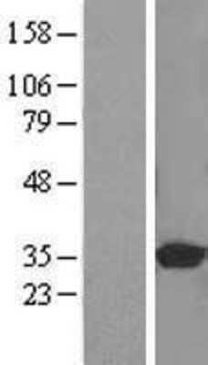 Western Blot: PITPNB Overexpression Lysate [NBL1-14443]