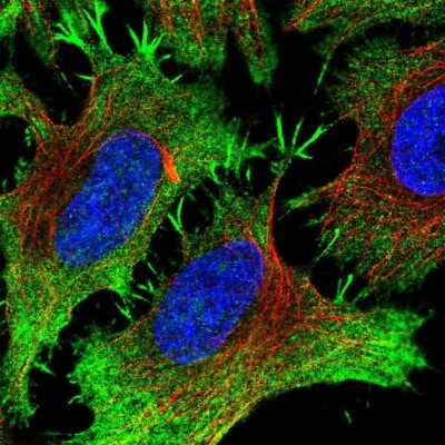 Immunocytochemistry/ Immunofluorescence: PITPNM3 Antibody [NBP2-33894]