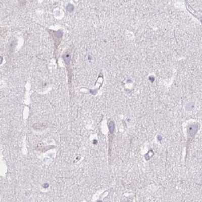 Immunohistochemistry-Paraffin: PITPNM3 Antibody [NBP2-34121]