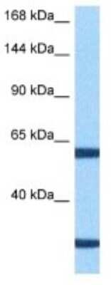 Western Blot: PITPNM3 Antibody [NBP3-10019]