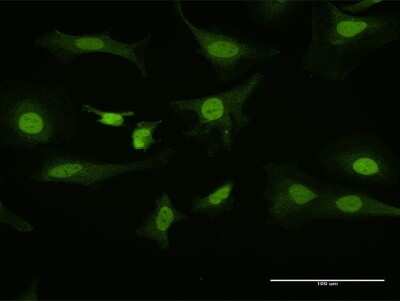 Immunocytochemistry/ Immunofluorescence: PITX1 Antibody [H00005307-D01P]