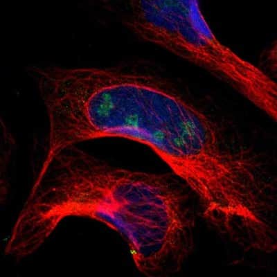 Immunocytochemistry/ Immunofluorescence: PITX1 Antibody [NBP1-88644]