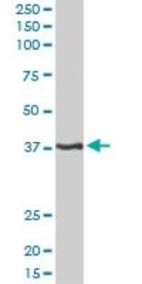 Western Blot: PITX1 Antibody [H00005307-D01P]