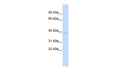 Western Blot: PITX3 Antibody [NBP2-85479]