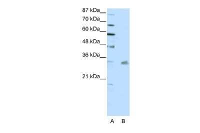 Western Blot: PITX3 Antibody [NBP2-85482]