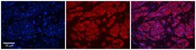 Immunohistochemistry: PIWIL1/HIWI Antibody [NBP1-55299]