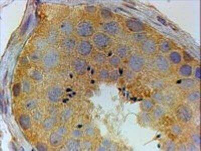 Immunohistochemistry-Paraffin: PIWIL1/HIWI Antibody [NBP1-06062]