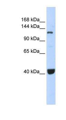 Western Blot: PIWIL1/HIWI Antibody [NBP1-54796]