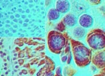 Immunohistochemistry-Paraffin: PIWIL2 Antibody [NBP2-24590]