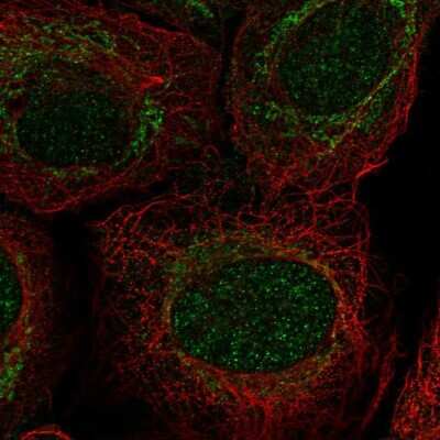 Immunocytochemistry/ Immunofluorescence: PIWIL4 Antibody [NBP2-68631]