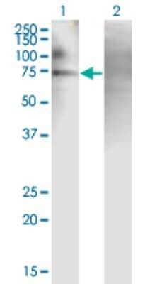 Western Blot: PJA2/Praja2 Antibody (1G11) [H00009867-M01]