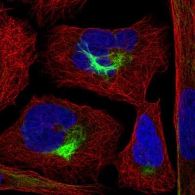 Immunocytochemistry/ Immunofluorescence: PJA2/Praja2 Antibody [NBP2-56901]