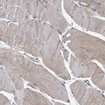 Immunohistochemistry-Paraffin: PJA2/Praja2 Antibody [NBP1-83006]