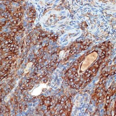 Immunohistochemistry-Paraffin: PKA 2 beta Antibody (2U2P1) [NBP3-15890]