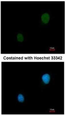 Immunocytochemistry/ Immunofluorescence: PKA 2 beta Antibody [NBP1-33773]