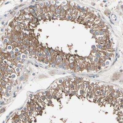 Immunohistochemistry-Paraffin: PKA 2 beta Antibody [NBP1-80879]