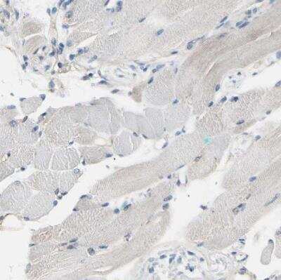 Immunohistochemistry-Paraffin: PKA 2 beta Antibody [NBP1-80879]