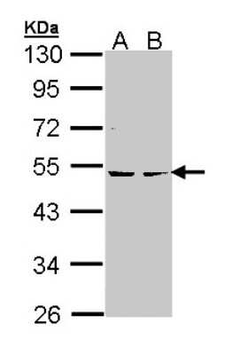 Western Blot: PKA 2 beta Antibody [NBP1-33773]