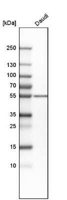 Western Blot: PKA 2 beta Antibody [NBP1-80879]