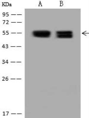 Western Blot: PKA 2 beta Antibody [NBP3-12636]