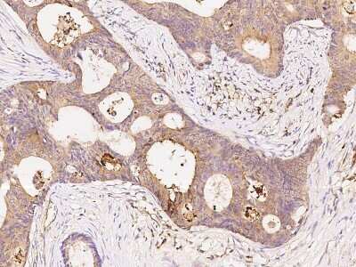 Immunohistochemistry-Paraffin: PKA C alpha Antibody [NBP2-99335]