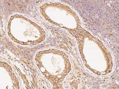 Immunohistochemistry-Paraffin: PKA C alpha Antibody [NBP2-99335]
