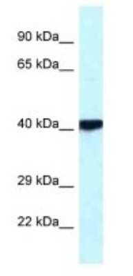 Western Blot: PKA C beta Antibody [NBP1-55008]