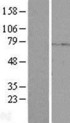 Western Blot: PKA C beta Overexpression Lysate [NBP2-04480]