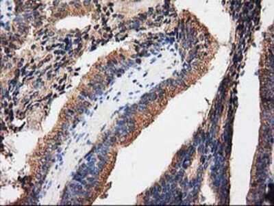 Immunohistochemistry-Paraffin: PKA R2 Antibody (OTI1F8) [NBP2-02520]